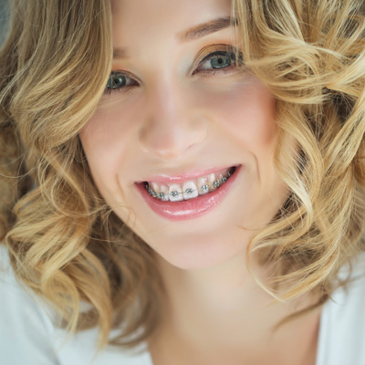 A woman with braces and blonde hair smiling at the camera.
